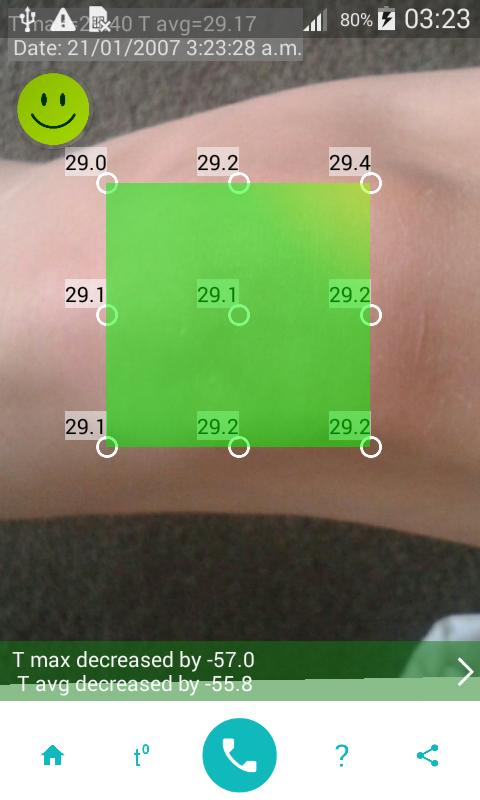 SMAT Thermometer Lite