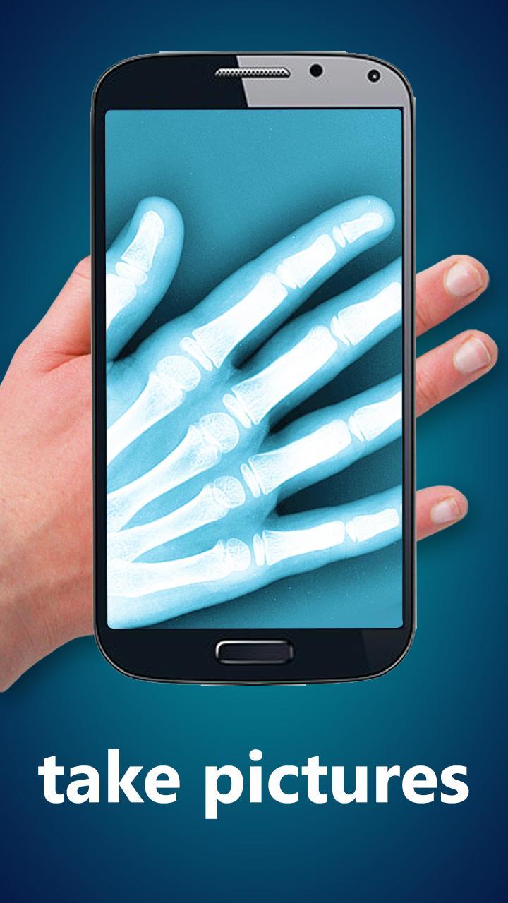 Xray Prank
